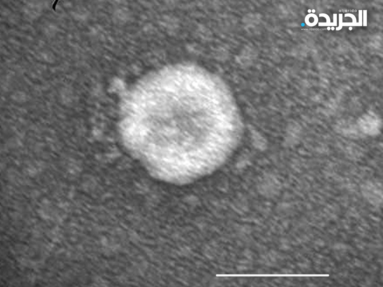 قبرص تعلن عن اكتشاف إصابات مجهولة بـ «دلتاكرون»!