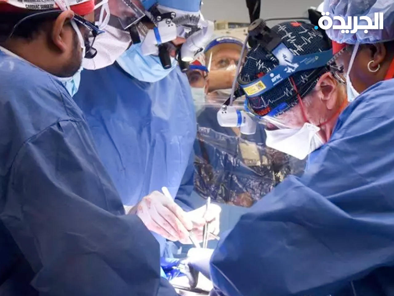 جانب من عملية الزراعة