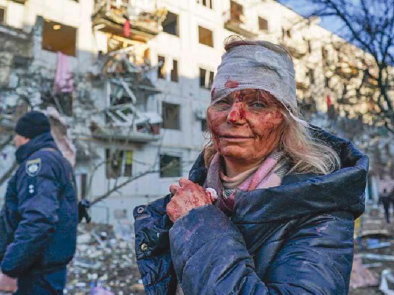 أوكرانية مصابة بشظايا قذيفة روسية أمس