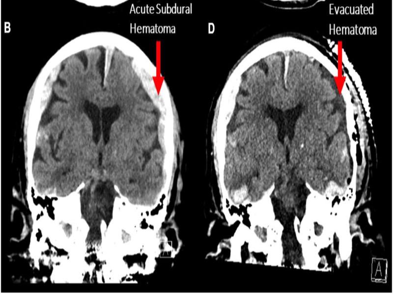 هل يُمكن أن نرى شريط حياتنا أمام أعيننا في لحظة الموت؟