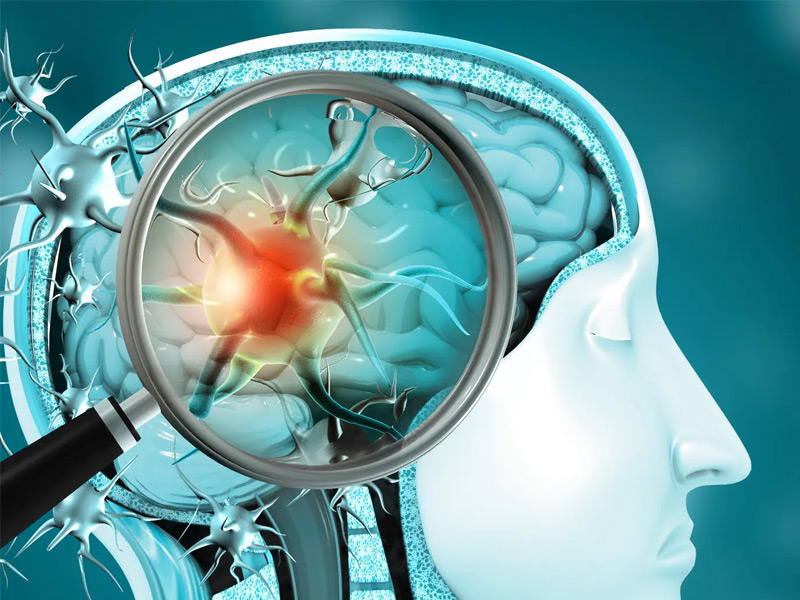 تأثير كورونا على الدماغ