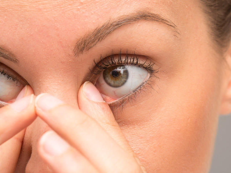 حكة الجفن من أعراض الإصابة بنوع نادر من السرطان