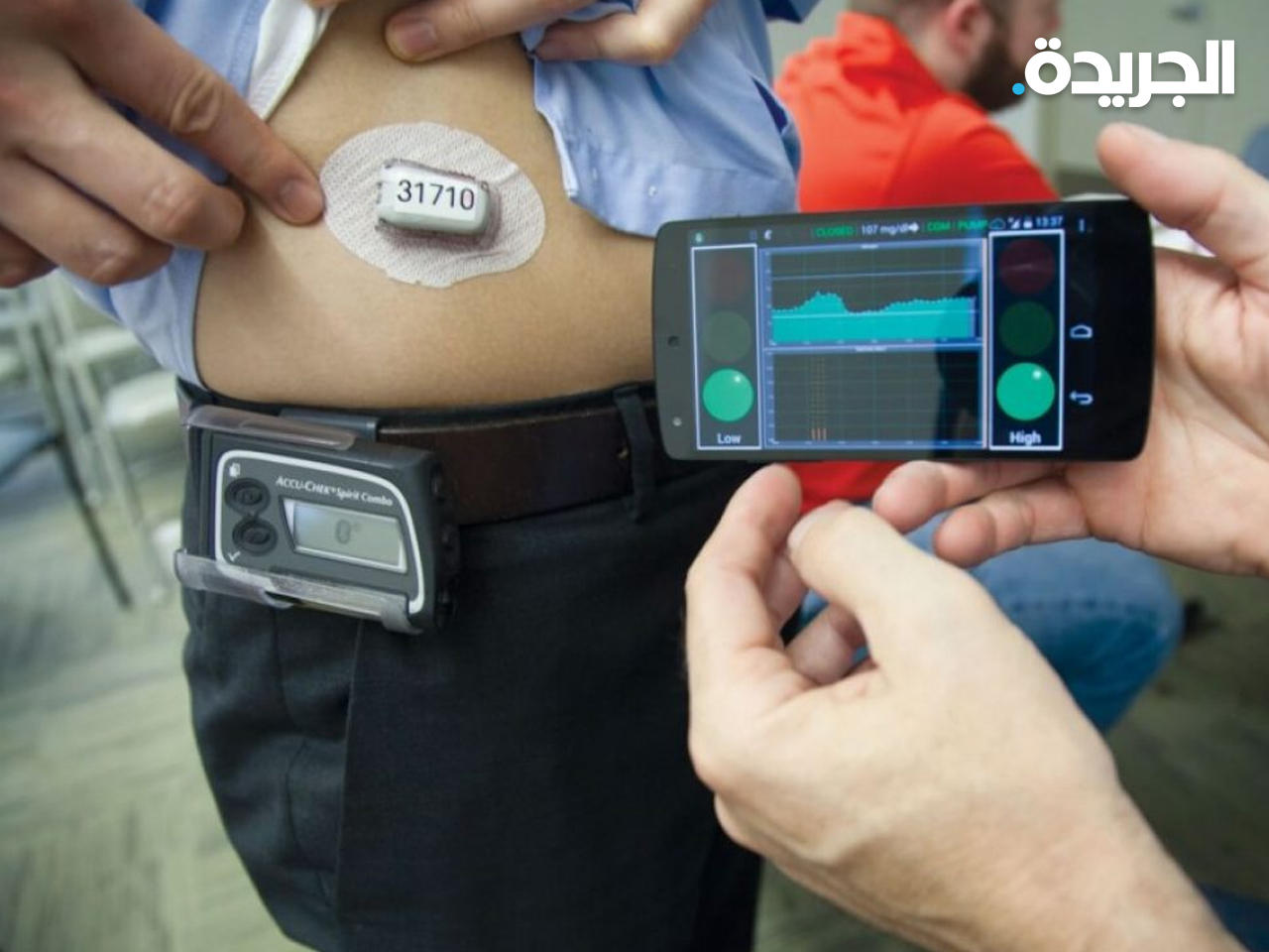 البنكرياس الاصطناعي يُحدث ثورة في رعاية مرضى السكري