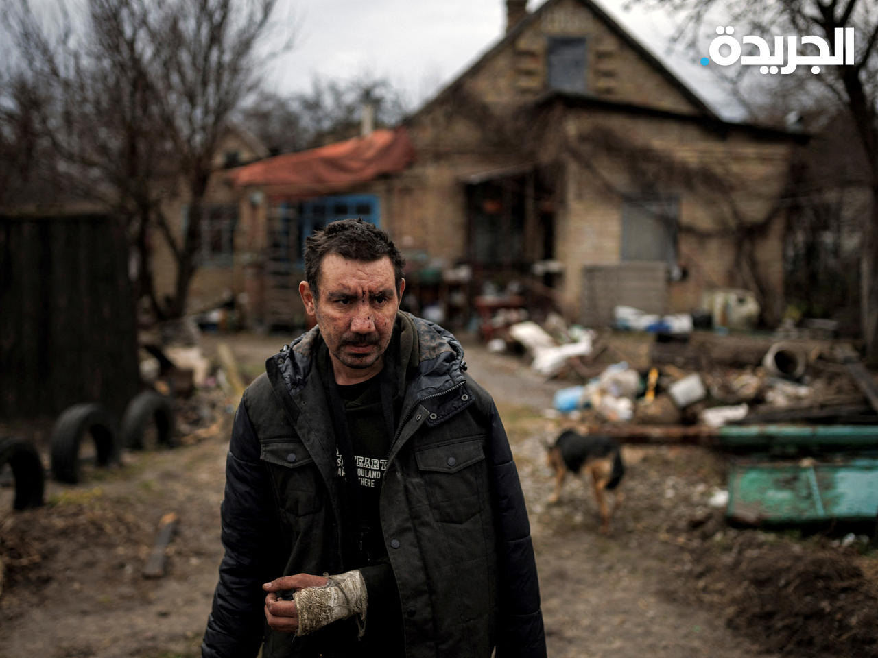 أوكراني يتهم جنود روس بكسر ذراعه، في بوتشا