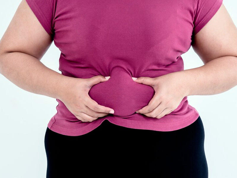 فقدت 114 كيلوغراماً من وزنها