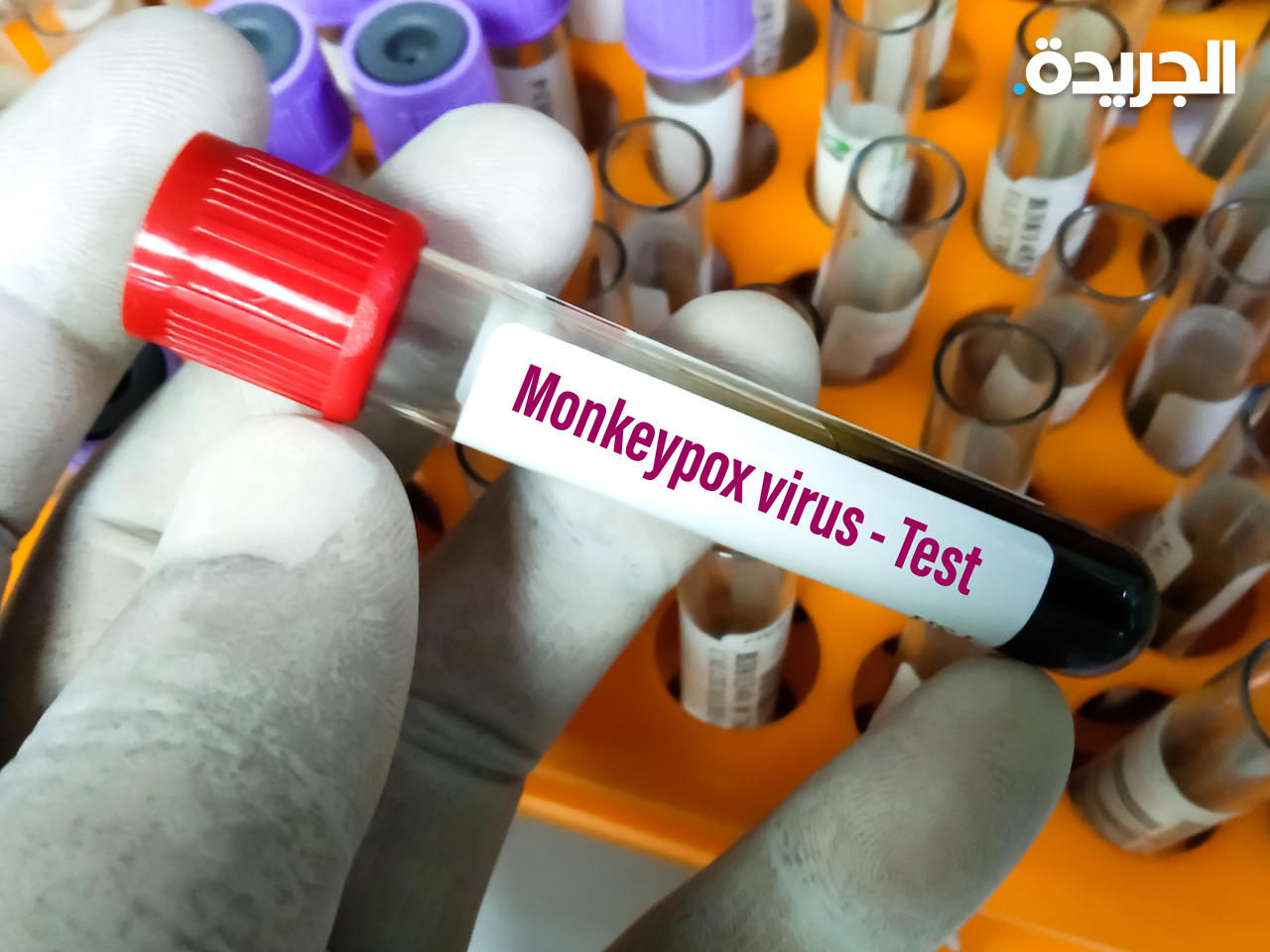 بريطانيا ترصد 36 حالة إصابة جديدة بـ «جدري القردة»