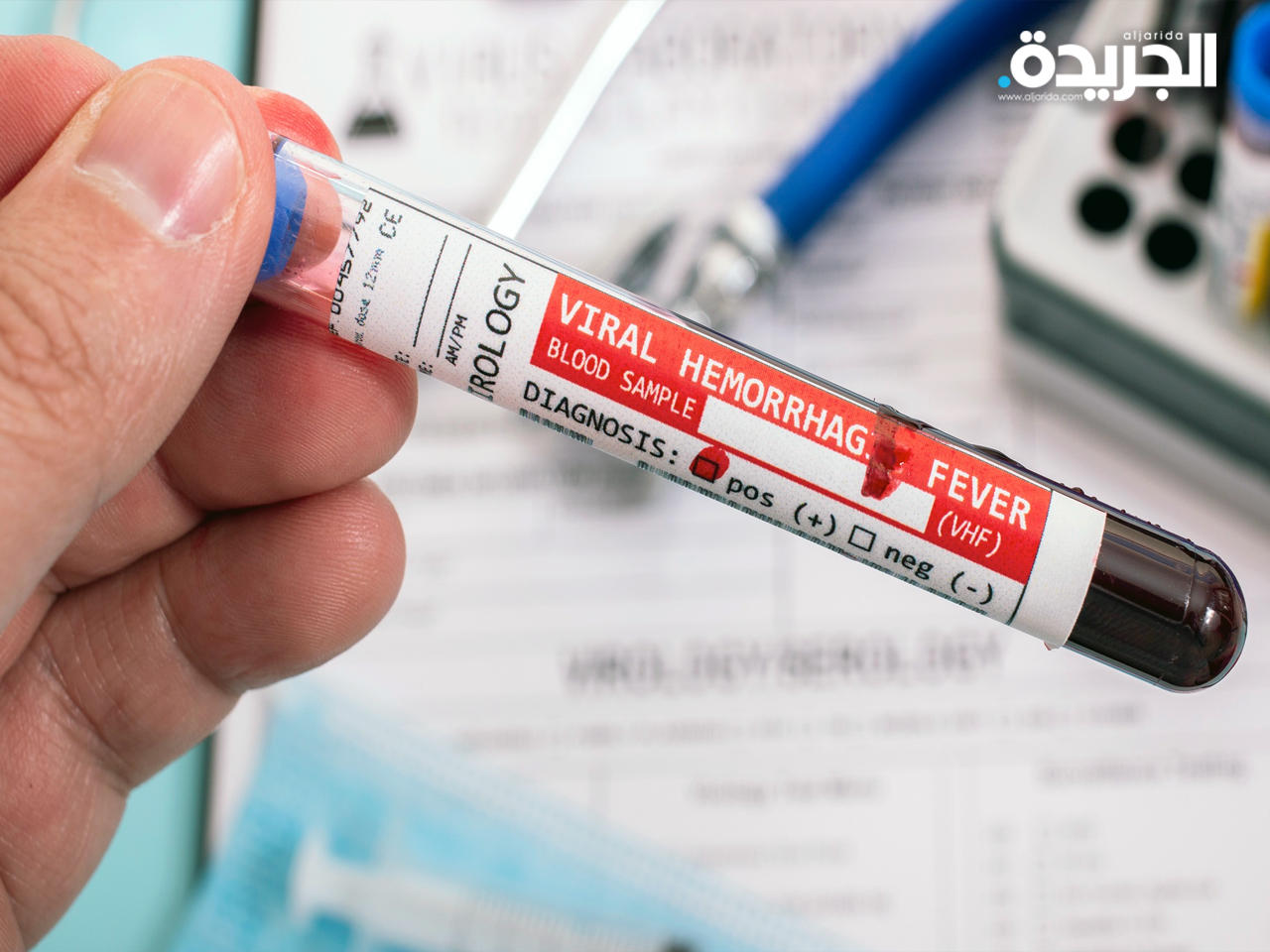 الحمى النزفية