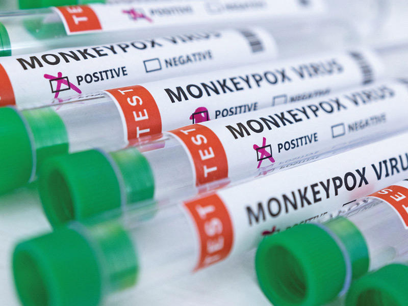 مخاوف دولية من تفشي مرض جدري القرود