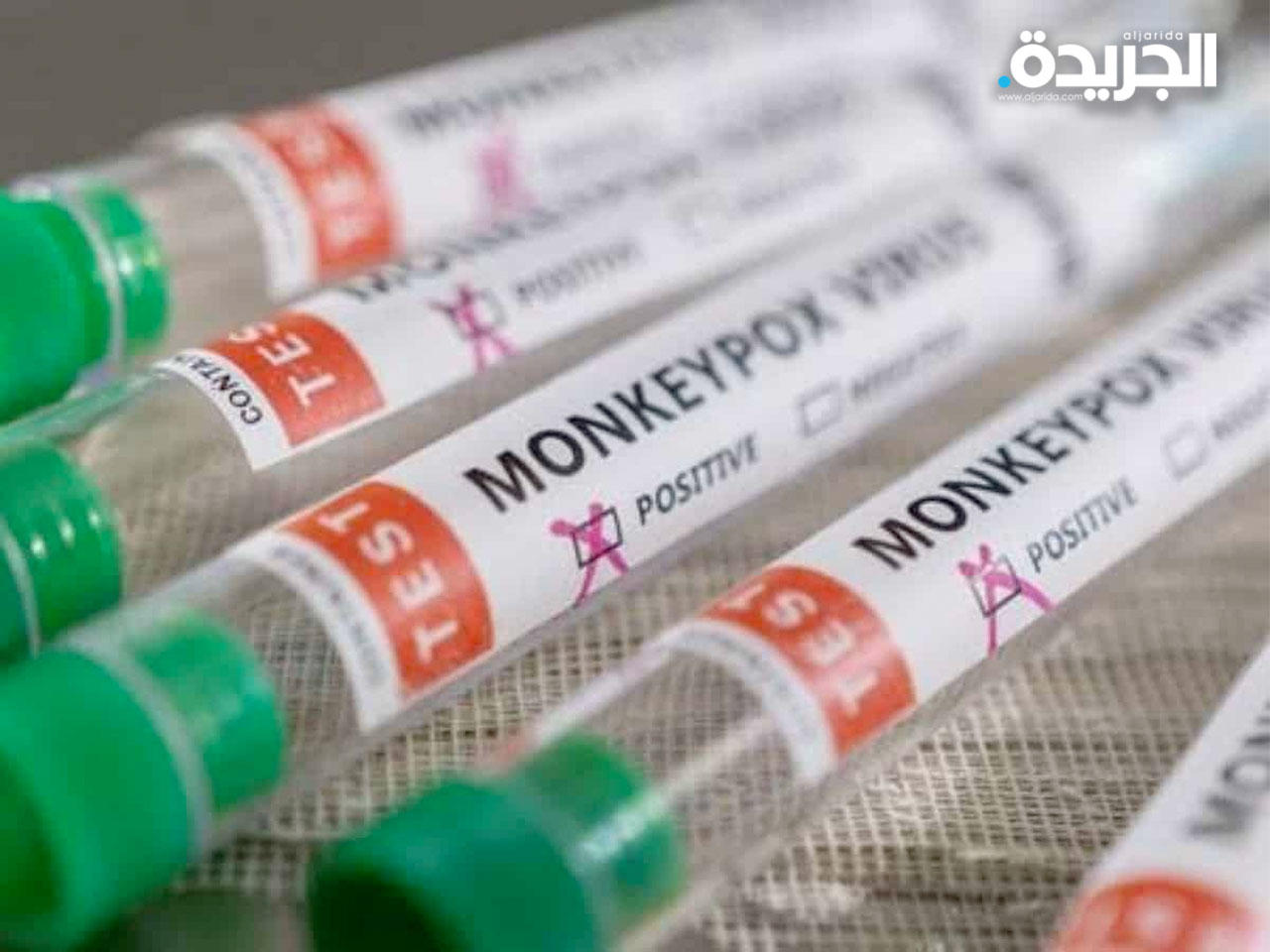 فيروس «جدري القرود»