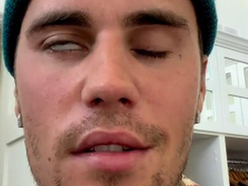 مغني البوب الكندي جاستن بيبر 