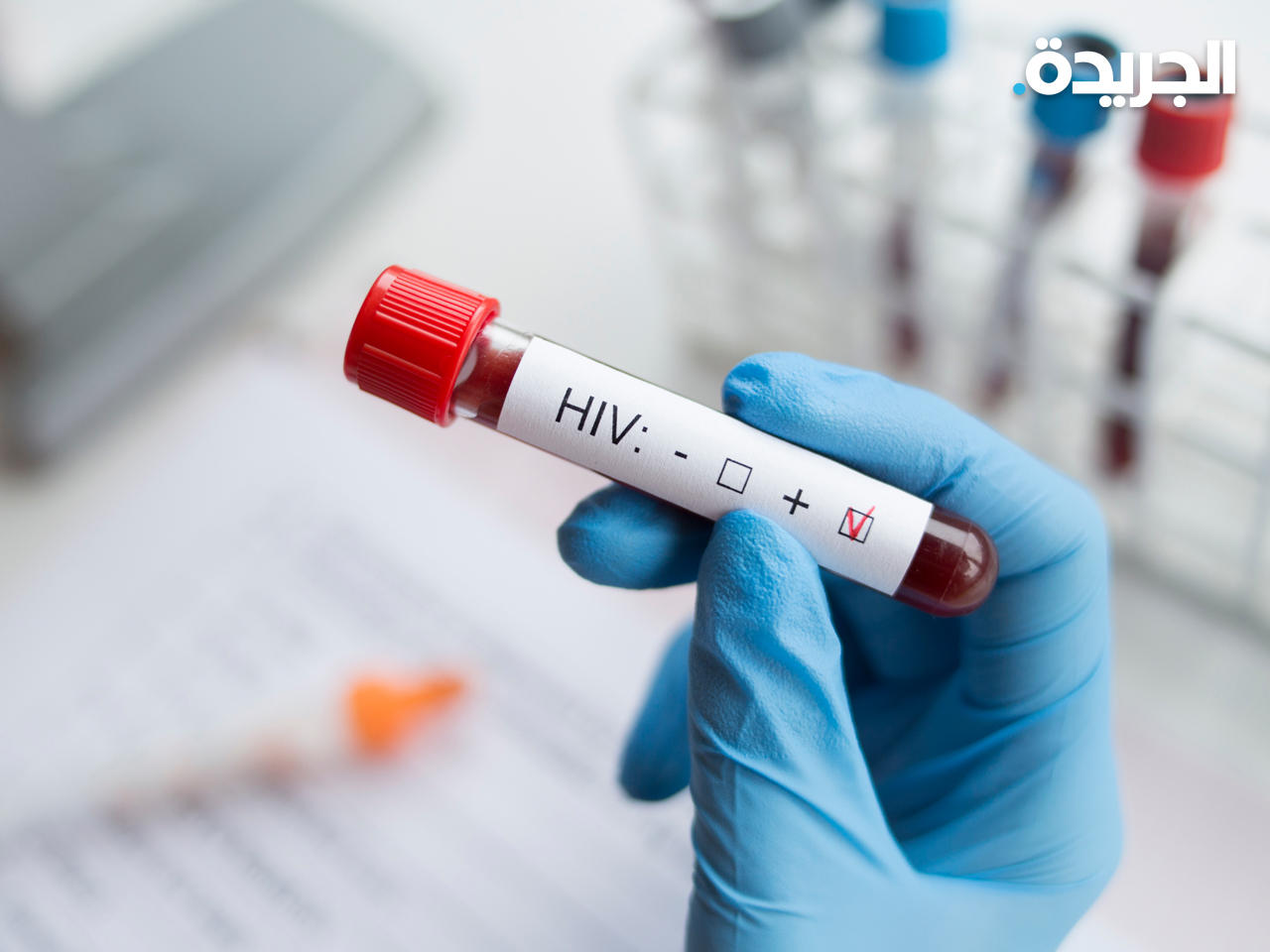«الصحة» تلزم المستشفيات بإجراء فحص فيروس نقص المناعة لمرضى الدرن