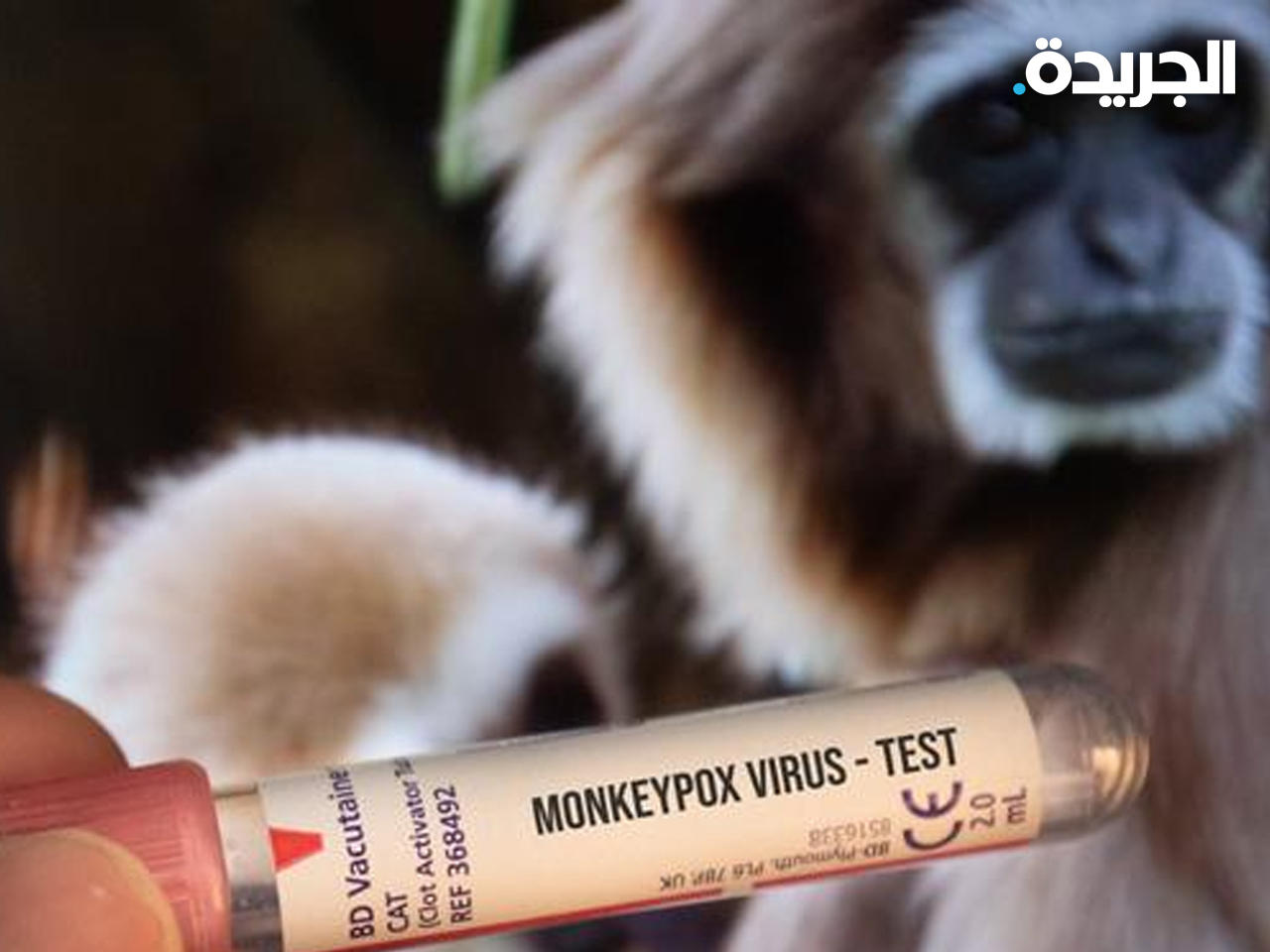 «جدري القرود»