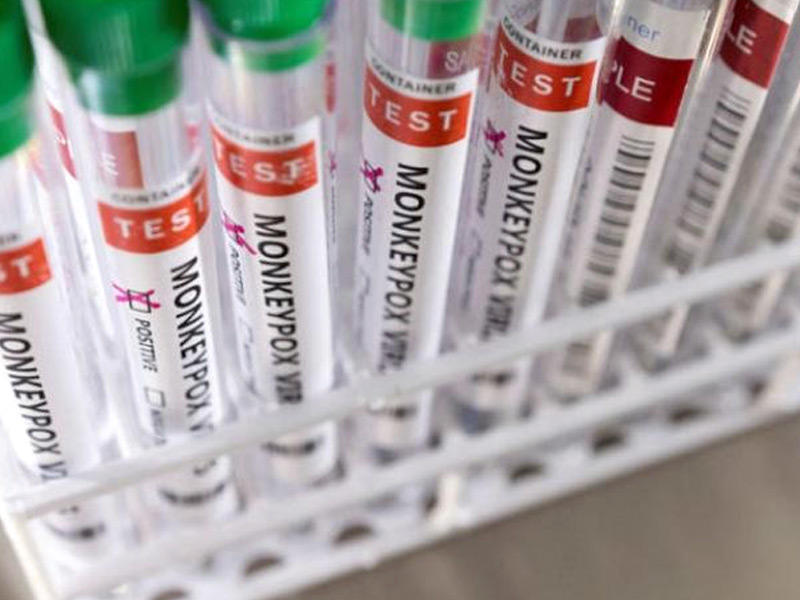 اختبارات فيروس جدري القرود 