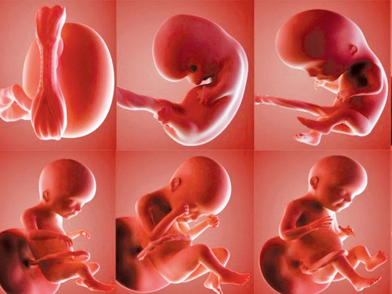 صورة للجنين