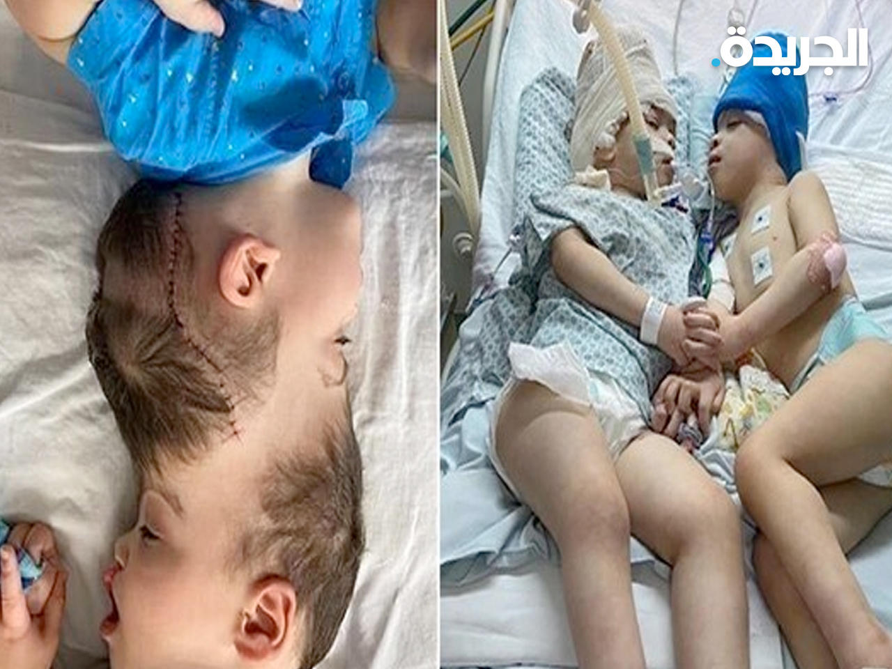 صورة التوأمين