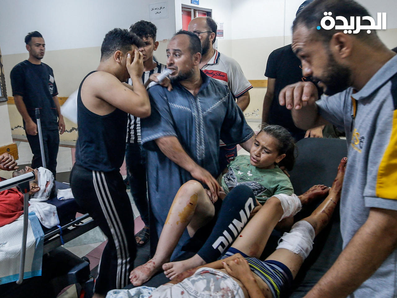 طفلة مصابة في المستشفى جراء القصف الإسرائيلي 