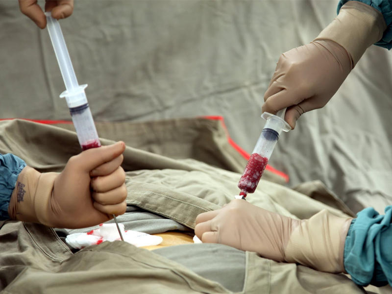 طريقة زرع الخلايا الجذعية