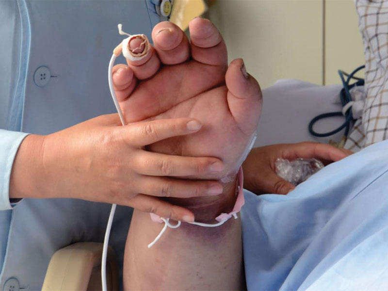 مصري يموت بعد عملية «تكميم»