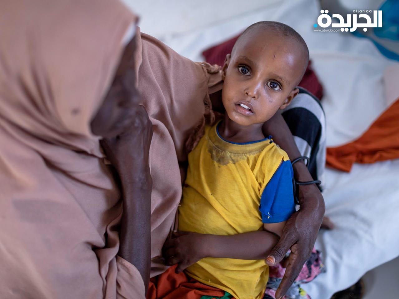 الجوع ينهش أطفال الصومال