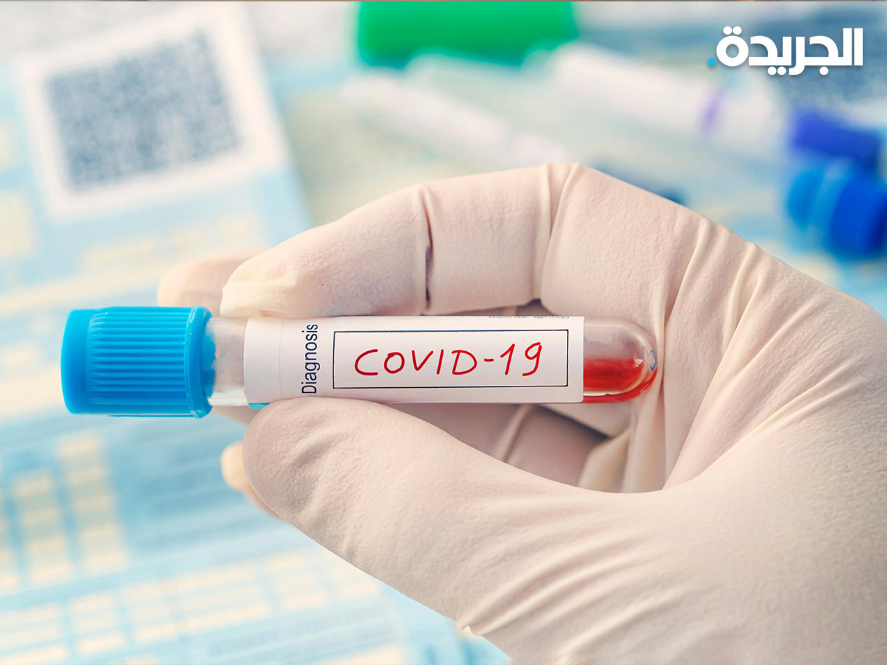 حالتا وفاة و203 إصابات بـ«كورونا» في السعودية خلال 24 ساعةn